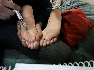gemartelde voeten